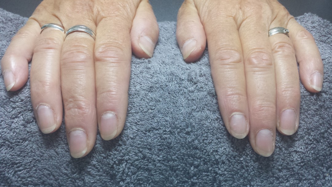 Naturnagelverstärkung Fingerschick
